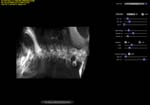 lateral cervical spine projection